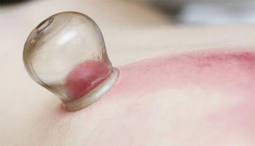 �ι޼�����Ч�� ��ҽ�ι���ɶ�ô�